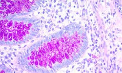 Periodic acid–Schiff (PAS) staining